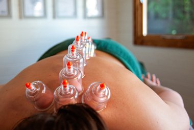 Dry Cupping at best holistic wellbeing clinic in Poole, Dorset
