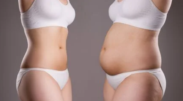 Post Surgery Manual Lymphatic Drainage at Best Aesthetics Clinic in Poole Dorset