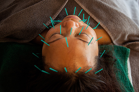 ACUPUNCTURE-EXPERTS-NEAR-ME-IN-POOLE-DORSET