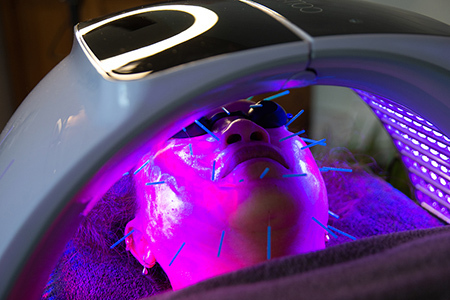 LED-LIGHT-THERAPY-AND-ACUPUNCTURE-AT-CLAIRES-MAGIC-TOUCH-STUDIO-POOLE