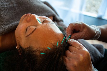 ACUPUNCTURE-AT-CLAIRES-MAGIC-TOUCH-STUDIO IN POOLE